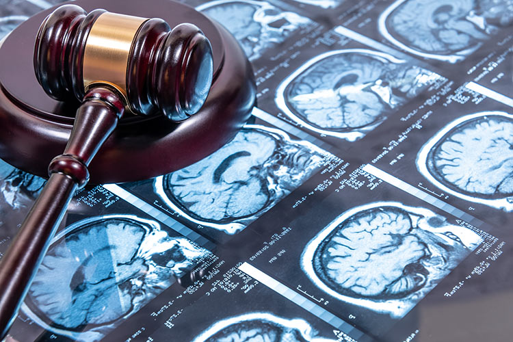 Slip and Fall Personal Injury Cases